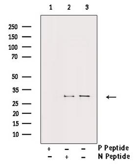 ATF1 Antibody - Western blot analysis of Phospho-ATF1 (Ser63) antibody expression in Insulin treated HT29 cells lysates. The lane on the right is treated with the antigen-specific peptide.