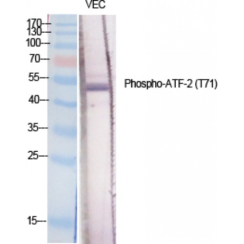 ATF2 Antibody - Western blot of Phospho-ATF-2 (T71) antibody