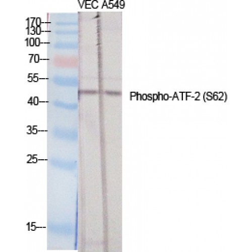 ATF2 Antibody - Western blot of Phospho-ATF-2 (S62) antibody