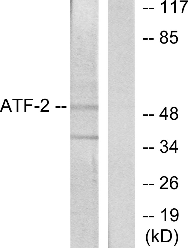 ATF2 Antibody - Western blot analysis of lysates from HeLa cells, using ATF2 Antibody. The lane on the right is blocked with the synthesized peptide.