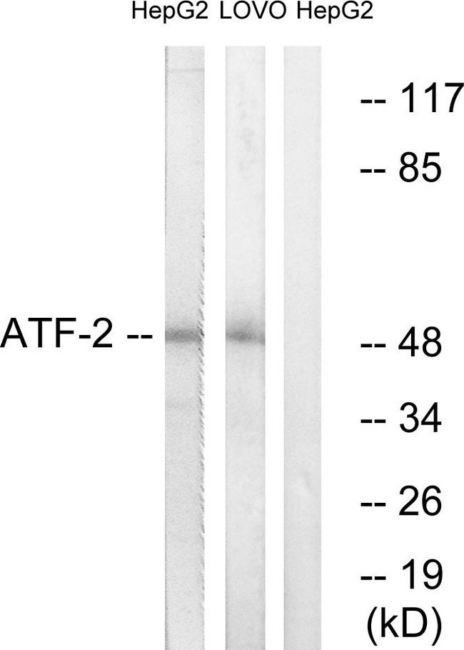 ATF2 Antibody - Western blot analysis of lysates from HepG2 and LOVO cells, using ATF2 Antibody. The lane on the right is blocked with the synthesized peptide.