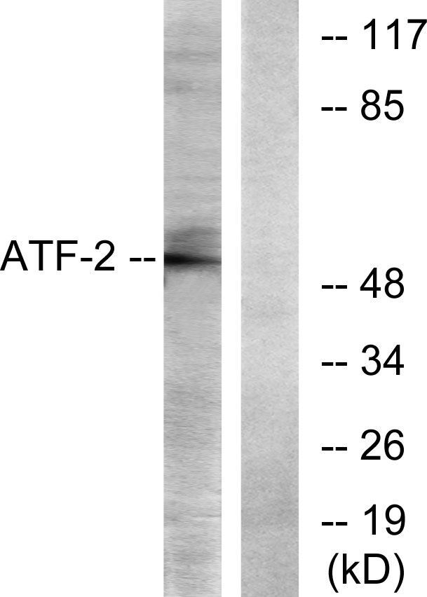 ATF2 Antibody - Western blot analysis of lysates from LOVO cells, using ATF2 Antibody. The lane on the right is blocked with the synthesized peptide.