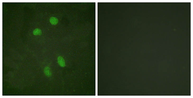ATF2 Antibody - Immunofluorescence analysis of HeLa cells, using ATF2 Antibody. The picture on the right is blocked with the synthesized peptide.