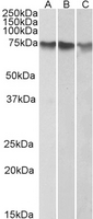 ATF2 Antibody - Goat Anti-ATF2 Antibody (1µg/ml) staining of HepG2 (A), K562 (B) and HeLa (C) nuclear lysates (35µg protein in RIPA buffer). Detected by chemiluminescencence.