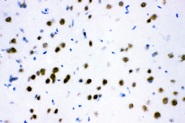 ATF2 Antibody - IHC analysis of ATF2 using anti-ATF2 antibody. ATF2 was detected in frozen section of rat brain tissue. Heat mediated antigen retrieval was performed in citrate buffer (pH6, epitope retrieval solution) for 20 mins. The tissue section was blocked with 10% goat serum. The tissue section was then incubated with 1µg/ml rabbit anti-ATF2 Antibody overnight at 4°C. Biotinylated goat anti-rabbit IgG was used as secondary antibody and incubated for 30 minutes at 37°C. The tissue section was developed using Strepavidin-Biotin-Complex (SABC) with DAB as the chromogen.