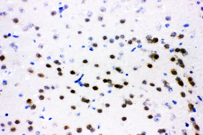 ATF2 Antibody - IHC analysis of ATF2 using anti-ATF2 antibody. ATF2 was detected in frozen section of mouse brain tissue. Heat mediated antigen retrieval was performed in citrate buffer (pH6, epitope retrieval solution) for 20 mins. The tissue section was blocked with 10% goat serum. The tissue section was then incubated with 1µg/ml rabbit anti-ATF2 Antibody overnight at 4°C. Biotinylated goat anti-rabbit IgG was used as secondary antibody and incubated for 30 minutes at 37°C. The tissue section was developed using Strepavidin-Biotin-Complex (SABC) with DAB as the chromogen.