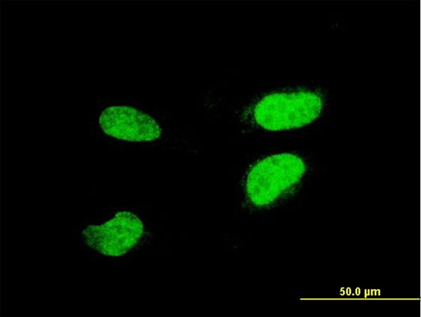 ATF2 Antibody - Immunofluorescence of monoclonal antibody to ATF2 on HeLa cell. [antibody concentration 10 ug/ml].