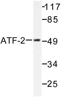 ATF2 Antibody - Western blot of ATF2 (G56/39) pAb in extracts from HeLa cells.