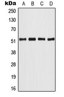 ATF2 Antibody - Western blot analysis of ATF2 expression in HeLa (A); NIH3T3 (B); PC12 (C); rat brain (D) whole cell lysates.