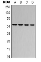 ATF2 Antibody - Western blot analysis of ATF2 expression in HeLa (A); MCF7 (B); SP20 (C); rat brain (D) whole cell lysates.
