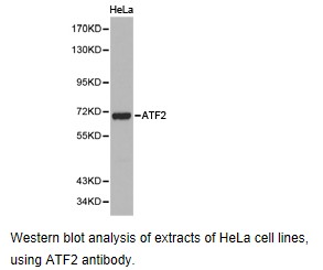 ATF2 Antibody - Western blot.