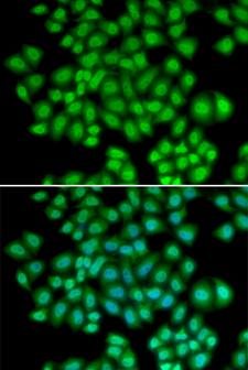 ATF2 Antibody - Immunofluorescence analysis of U20S cells.