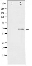 ATF2 Antibody - Western blot of ATF2 expression in HeLa whole cell lysates,The lane on the left is treated with the antigen-specific peptide.