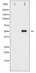 ATF2 Antibody - Western blot of ATF2 expression in MDA-MB-435 whole cell lysates,The lane on the left is treated with the antigen-specific peptide.