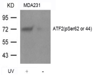 ATF2 Antibody - Detection of ATF2 (phospho-Ser62 or 44) in extracts of MDA231 cells treated with UV or untreated.