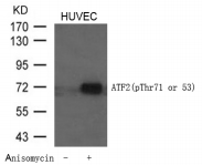 ATF2 Antibody - Detection of ATF2 (phospho-Thr71 or 53) in extracts of HUVEC cells untreated or treated with Anisomycin.