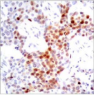 ATF2 Antibody - Detection of ATF2 (phospho-Thr69 or 51) in extracts of 3T3 cells untreated or treated with Anisomycin.