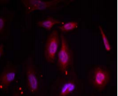 ATF2 Antibody - Detection of ATF2 (phosphor-Thr 69 or 51) in methanol-fixed HeLa cells.