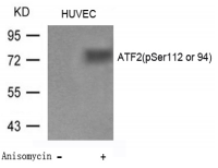 ATF2 Antibody - Detection of ATF2 (phospho-Ser112 or 94) in extracts of Huvec cells untreated or treated with Anisomycin.