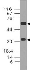 ATF2 Antibody - Fig-1: Western blot analysis of ATF2. Anti-ATF2 antibody was tested at 2 µg/ml on PC3 lysate.
