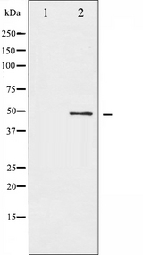 ATF2 Antibody - Western blot analysis of ATF2 expression in HeLa whole cells lysates. The lane on the left is treated with the antigen-specific peptide.