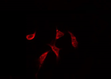 ATF2 Antibody - Staining HeLa cells by IF/ICC. The samples were fixed with PFA and permeabilized in 0.1% Triton X-100, then blocked in 10% serum for 45 min at 25°C. The primary antibody was diluted at 1:200 and incubated with the sample for 1 hour at 37°C. An Alexa Fluor 594 conjugated goat anti-rabbit IgG (H+L) Ab, diluted at 1/600, was used as the secondary antibody.