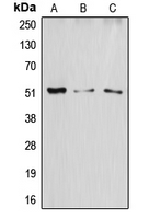 ATF2 Antibody - Western blot analysis of ATF2 expression in HeLa (A); SP2/0 (B); H9C2 (C) whole cell lysates.