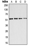 ATF2 Antibody - Western blot analysis of ATF2 expression in HeLa (A); MCF7 (B); NIH3T3 (C); PC12 (D) whole cell lysates.