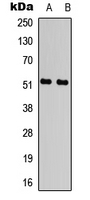 ATF2 Antibody - Western blot analysis of ATF2 (pT71) expression in HUVEC UV-treated (A); HEK293T UV-treated (B) whole cell lysates.