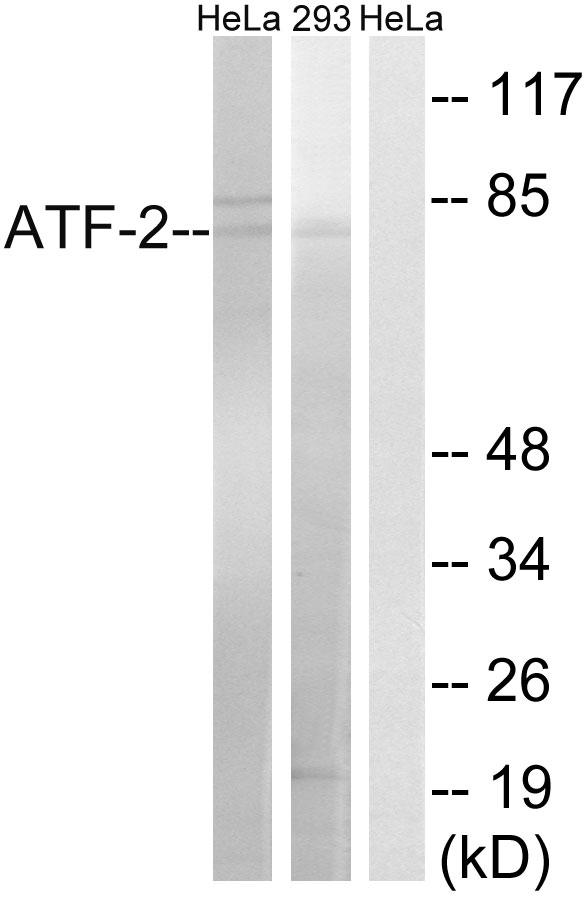 ATF2 Antibody - Western blot analysis of extracts from HeLa cells and 293 cells, using ATF-2 (Ab-472) antibody.