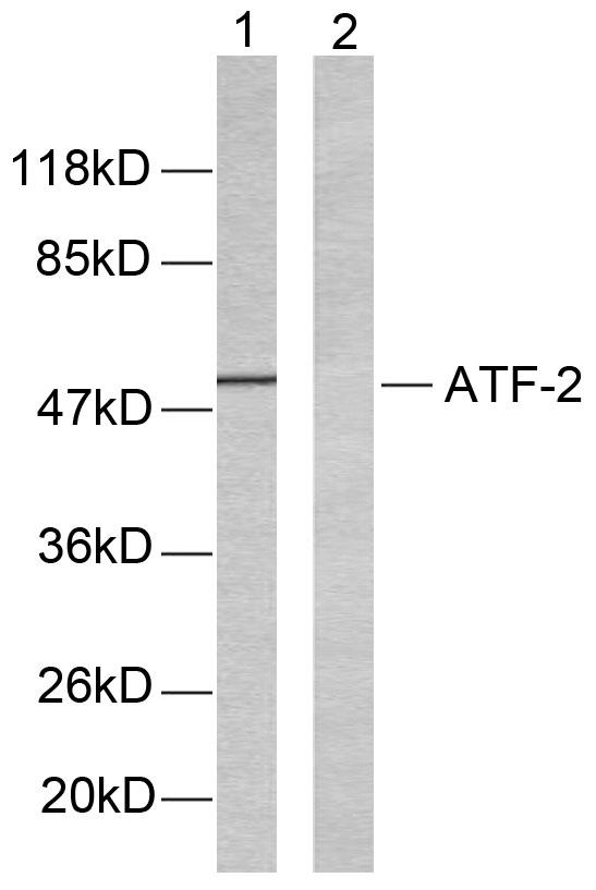 ATF2 Antibody - Western blot analysis of extracts from LOVO cells using ATF-2(Ab-51 or 53) Antibody.