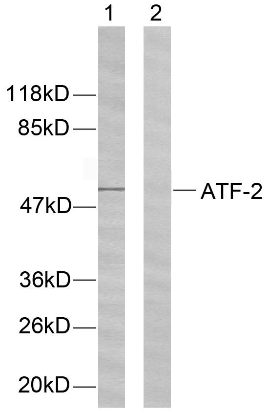 ATF2 Antibody - Western blot analysis of extracts from HeLa cells using ATF-2 (Ab-62 or 44) antibody.