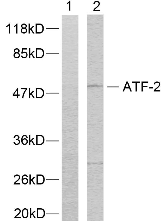ATF2 Antibody - Western blot analysis of extracts from LOVO cells using ATF-2 (Ab-73 or 55) antibody.