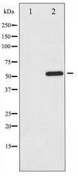 ATF2 Antibody - Western blot of ATF2 phosphorylation expression in MDA-MB-435 whole cell lysates,The lane on the left is treated with the antigen-specific peptide.