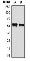 ATF2 Antibody - Western blot analysis of ATF2 (pS112) expression in HeLa (A); A549 (B) whole cell lysates.