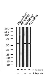 ATF2 Antibody - Western blot analysis of Phospho-ATF2 (Ser112 or 94) expression in various lysates