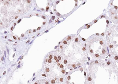 ATF2 Antibody - 1:100 staining human kidney tissue by IHC-P. The tissue was formaldehyde fixed and a heat mediated antigen retrieval step in citrate buffer was performed. The tissue was then blocked and incubated with the antibody for 1.5 hours at 22°C. An HRP conjugated goat anti-rabbit antibody was used as the secondary.