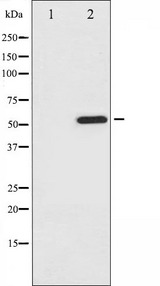 ATF2 Antibody - Western blot analysis of ATF2 phosphorylation expression in MDA-MB-435 whole cells lysates. The lane on the left is treated with the antigen-specific peptide.