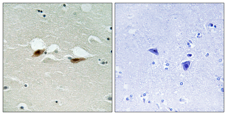 ATF2 Antibody - Immunohistochemistry analysis of paraffin-embedded human brain, using ATF-2 (Phospho-Ser472) Antibody. The picture on the right is blocked with the phospho peptide.