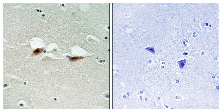 ATF2 Antibody - P-peptide - + Immunohistochemistry analysis of paraffin-embedded human brain tissue using ATF-2 (Phospho-Ser472) antibody.