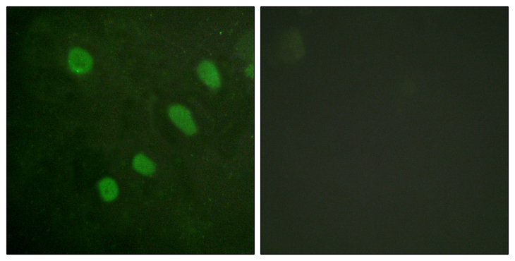ATF2 Antibody - Immunofluorescence analysis of HeLa cells, using ATF2 (Phospho-Ser480) Antibody. The picture on the right is blocked with the phospho peptide.