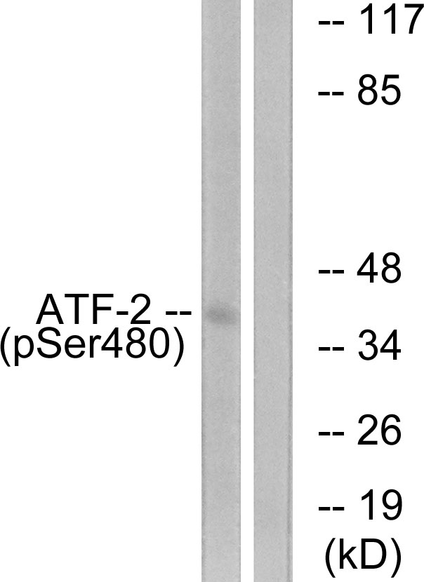 ATF2 Antibody - Western blot analysis of lysates from HUVEC cells treated with Anisomycin 25ug/ml 30', using ATF2 (Phospho-Ser480) Antibody. The lane on the right is blocked with the phospho peptide.