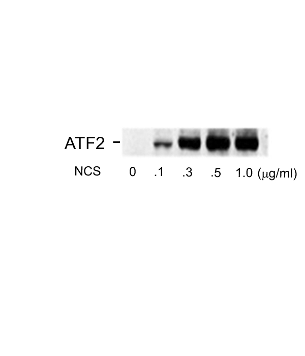 ATF2 Antibody - Western blot of human melanoma cells incubated with varying doses of the radiomimetic drug NCS showing specific immuno-labeling of the ~54k splice form of the phospho-ATF2 protein and the ~74k ATF2 protein phosphorylated at Ser490 and Ser498.