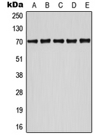 ATF2 Antibody - Western blot analysis of ATF2 (pS498) expression in HeLa UV-treated (A); Jurkat (B); NIH3T3 (C); SP2/0 UV-treated (D); MCF7 UV-treated (E) whole cell lysates.