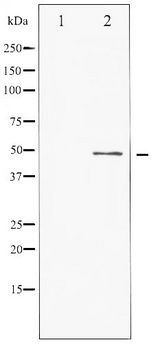 ATF2 Antibody - Western blot of ATF2 phosphorylation expression in TNF- alpha treated HeLa whole cell lysates,The lane on the left is treated with the antigen-specific peptide.