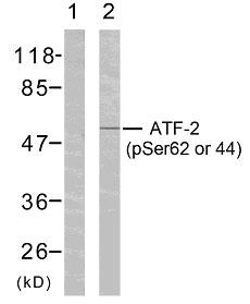 ATF2 Antibody - Western blot analysis of extracts from HeLa cells using ATF-2 (phospho-Ser62 or 44) antibody.