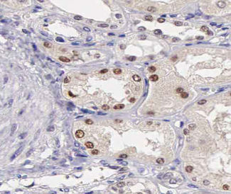 ATF2 Antibody - 1:200 staining human kidney tissue by IHC-P. The tissue was formaldehyde fixed and a heat mediated antigen retrieval step in citrate buffer was performed. The tissue was then blocked and incubated with the antibody for 1.5 hours at 22°C. An HRP conjugated goat anti-rabbit antibody was used as the secondary.
