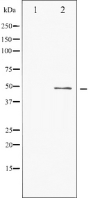 ATF2 Antibody - Western blot analysis of ATF2 phosphorylation expression in TNF-a treated HeLa whole cells lysates. The lane on the left is treated with the antigen-specific peptide.