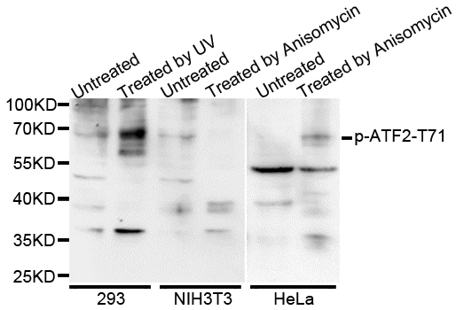 ATF2 Antibody - Western blot analysis of extracts of various cells.