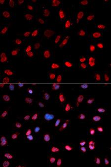 ATF2 Antibody - Immunofluorescence analysis of MCF7 cells.